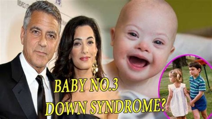 Understanding Alexander Clooney's Journey: Down's Syndrome And Beyond