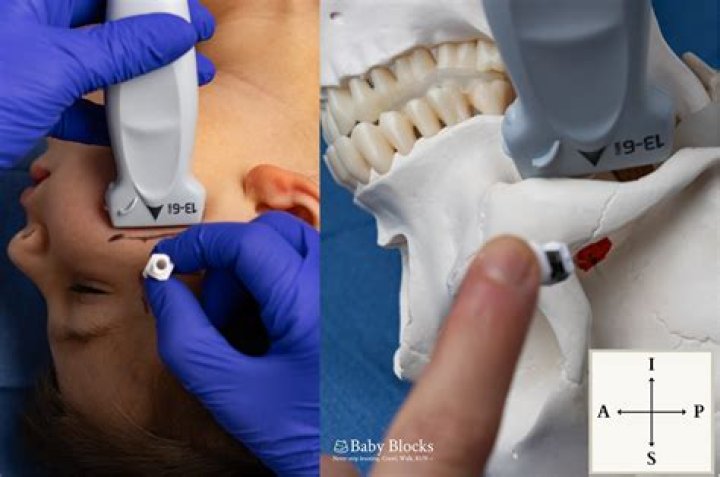 Understanding CSRDI In Infants: A Guide For Concerned Moms