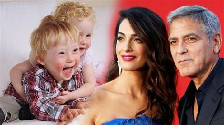 Understanding The Clooney Twins And Down Syndrome: A Heartfelt Exploration
